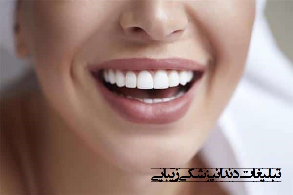بهترین روش تبلیغات دندانپزشکی زیبایی چیست؟